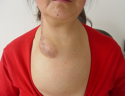 时间: 2011-04-06 来源: 天津市肿瘤医院